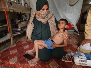 Cases of malnutrition among children in Gaza increases due to Israeli blockade